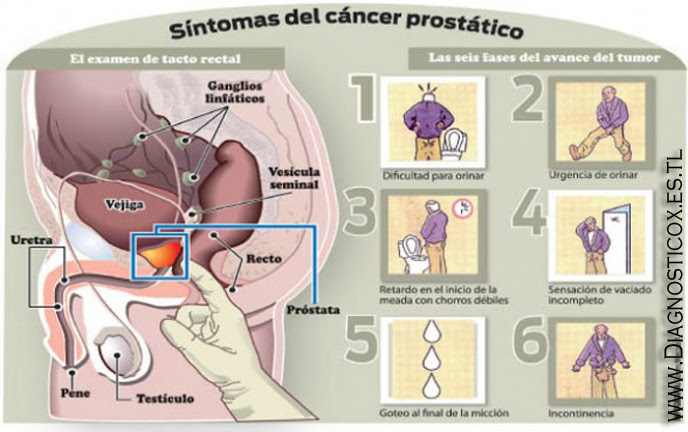 Duele la espalda a embarazado que untar